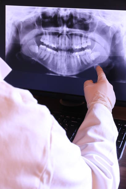Best Emergency Treatment for Dental Infections or Abscesses in Westhaven Moonstone, CA